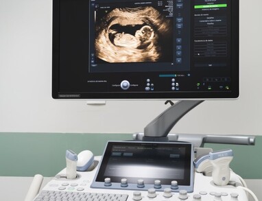 Equipamentos de ultrassonografia de alta performance e tecnologias avançadas 